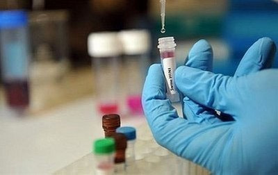 Sẽ xảy ra cuộc chiến giành giật vaccine cúm A H1N1?