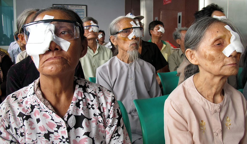 Phẫu thuật mắt cho bệnh nhân nghèo
