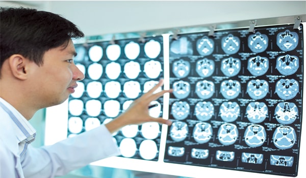 Cắt lát cơ thể