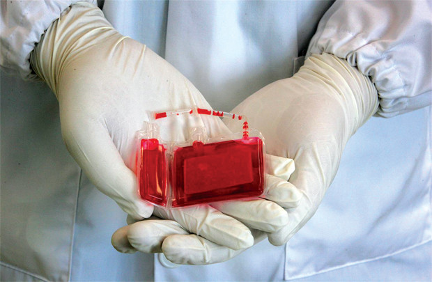 Lưu trữ tế bào gốc máu cuống rốn: Nên hay không?