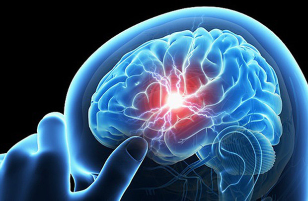 Đừng thờ ơ với chứng đau đầu - nguy cơ tử vong cao