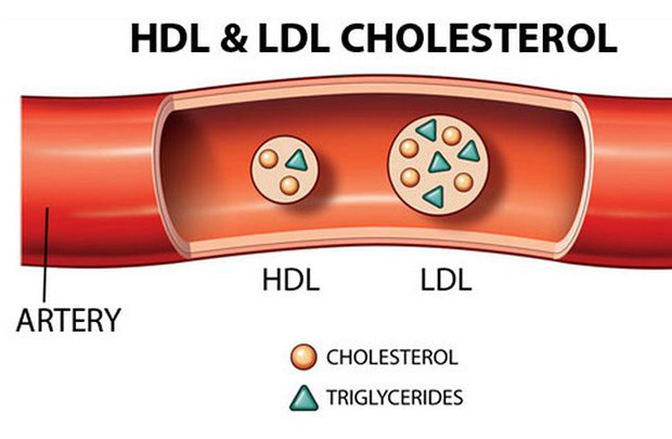 Cholesterol cao: Nguyên nhân và giải pháp