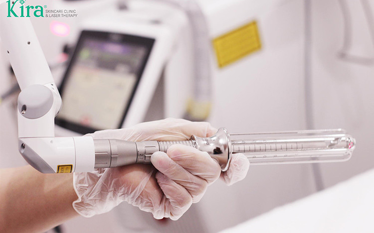 Kỹ thuật laser - Tin vui cho phái đẹp trong điều trị bệnh lý sàn chậu