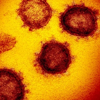 Virus SARS-CoV-2 gây bệnh Covid-19. (Nguồn: Statnews)