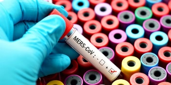 MERS - một trong số những dịch bệnh nguy hiểm gây ra bởi virus corona