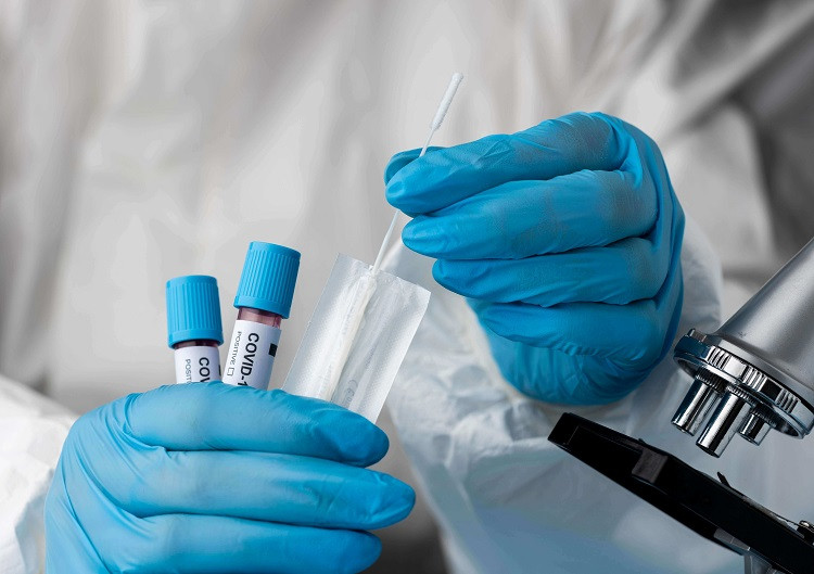 Bộ Y tế ban hành quy định xét nghiệm SARS-COV-2 tại cơ sở sản xuất, kinh doanh trong tình hình mới