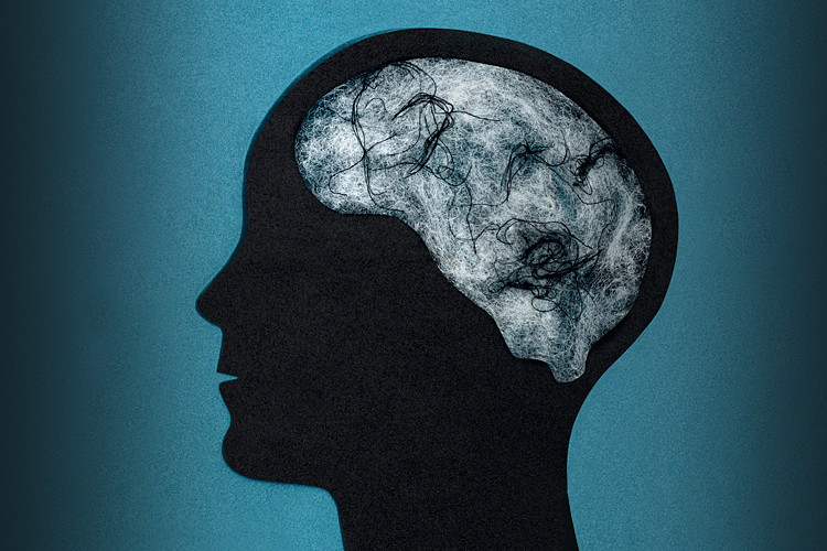 Theo các chuyên gia, hội chứng "não sương mù" hay còn gọi là hội chứng "sương mù não" mô tả một hoạt động não của người bệnh hoạt động không còn trơn tru, nhanh nhạy giống như ban đầu, họ khó tập trung, mau quên, khó đưa ra các quyết định dù vấn đề đó rất đơn giản.