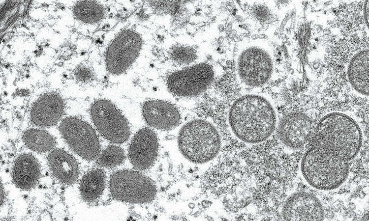 Hình ảnh hiển vi điện tử cho thấy virus đậu mùa khỉ từ một mẫu da người - Ảnh: Reuters