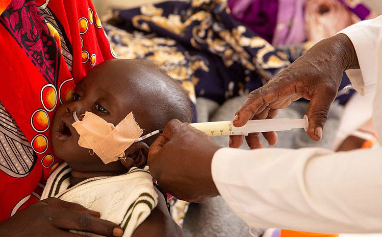 Một em bé 6 tháng tuổi suy dinh dưỡng ở Nam Sudan bởi hạn hán và nạn đói hoành hành trong khu vực, phải ăn sữa qua ống xông.