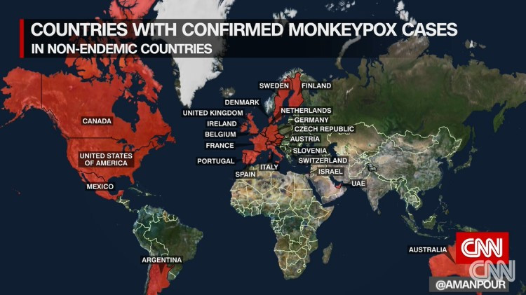 Đậu mùa khỉ xuất hiện ở 58 quốc gia, WHO có kế hoạch đánh giá lại về bệnh