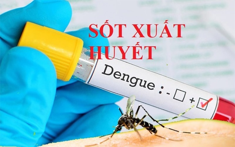 Sot xuat huyet