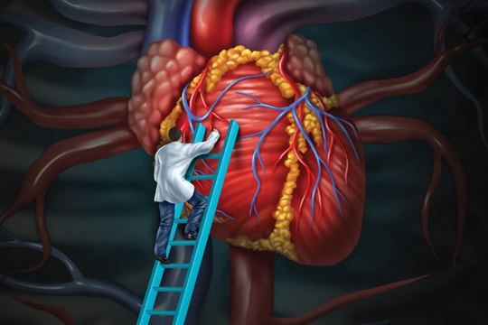 Nguy cơ bệnh tim mạch do rối loạn mỡ máu