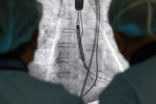 Thay van tim không cần phẫu thuật: Giải pháp an toàn, bệnh nhân hồi phục nhanh