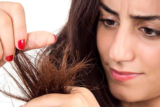 10 dấu hiệu cho thấy cơ thể cần được bổ sung vitamin C