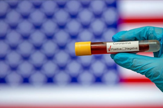 Số người nhiễm Covid-19 thực tế tại Mỹ có thể gấp 10 lần số liệu công bố