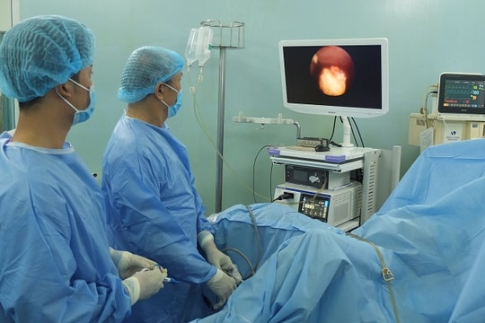 Dùng laser tán vỡ sỏi to trong bàng quang tân tạo 22 năm