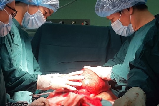 Phẫu thuật thành công khối u xơ nặng hơn 3 kg