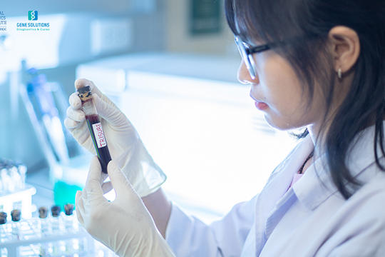 Xét nghiệm sàng lọc dị tật bẩm sinh- Bà mẹ mang thai cần biết