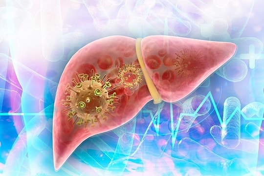Người có bệnh nền về gan khi mắc Covid-19 có nguy hiểm hơn?