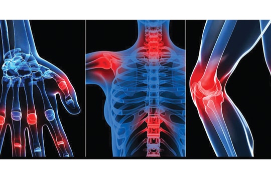 Giảm đau xương khớp tại nhà