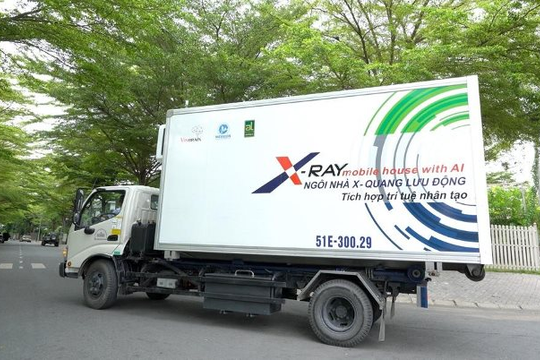 Ứng dụng Trí tuệ Nhân tạo, phát hiện đẩy lùi triệt để bệnh lao phổi