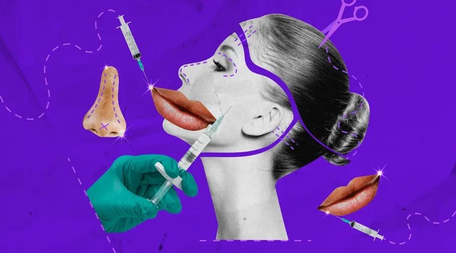 Người trẻ đổ xô thẩm mỹ vì áp lực đẹp cả trên mạng lẫn ngoài đời