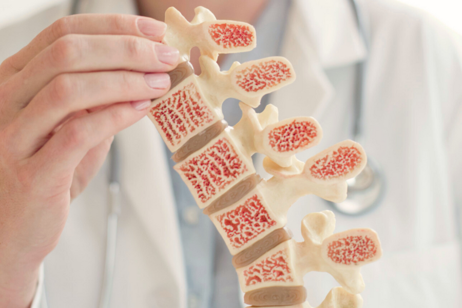 Đã tìm ra bí mật ngăn ngừa loãng xương